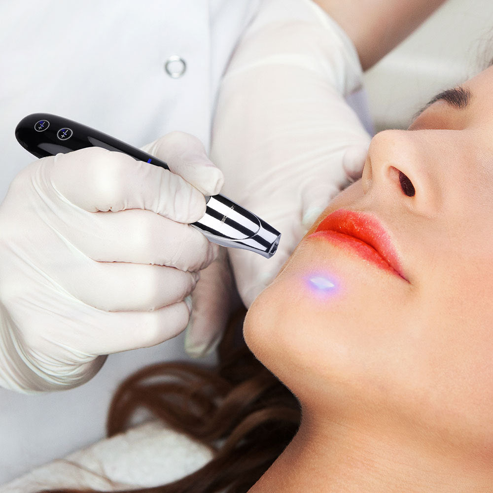 Picosecond Laser Pointer Removal Beauty Treatment